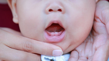 Image for La dentición del bebé y su relación con la dermatitis del pañal 