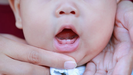Image for La dentición del bebé y su relación con la dermatitis del pañal 